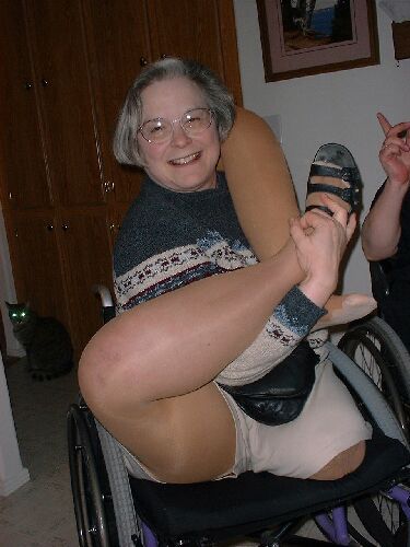 Amputee ART Amputee ART