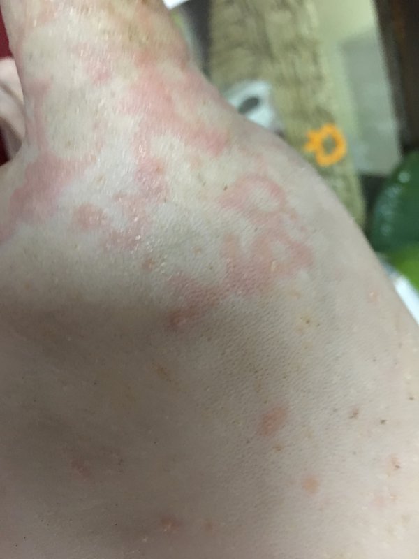 Коробейники 