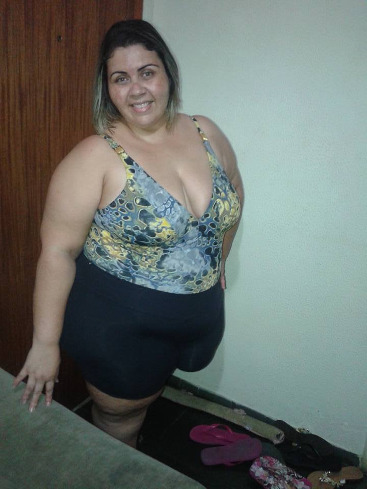 Amputee Ssbbw