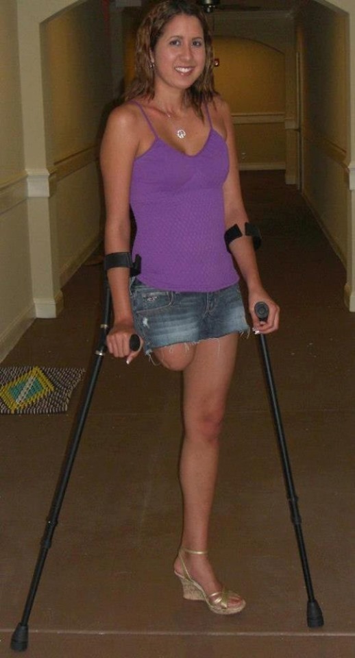 - Amputee woman on crutches! 