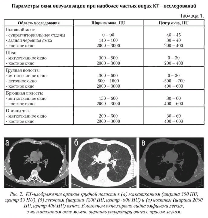 На формирование кт изображения оказывает непосредственное влияние
