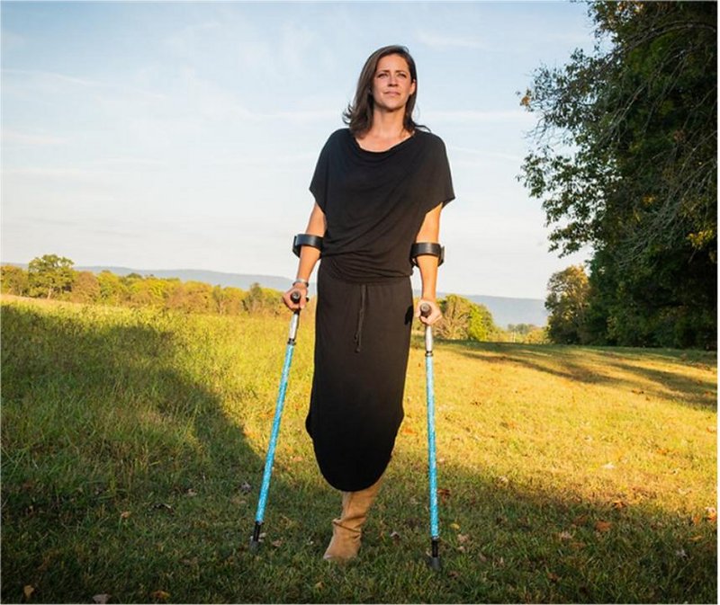 - Amputee woman on crutches! 