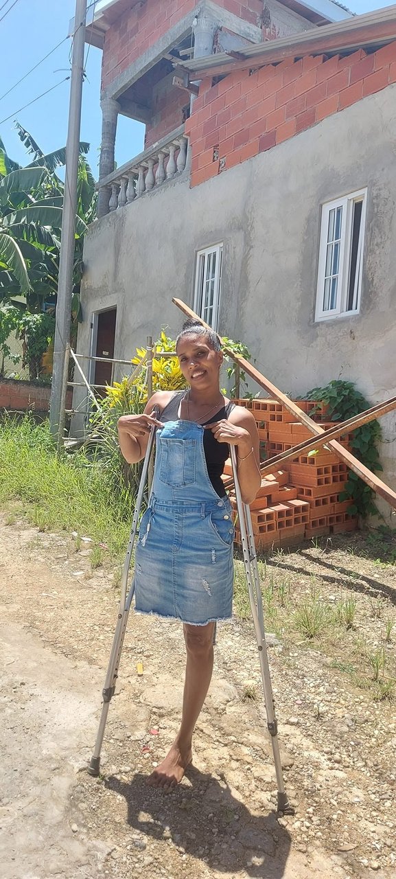 Девушки на костылях! - Amputee woman on crutches!