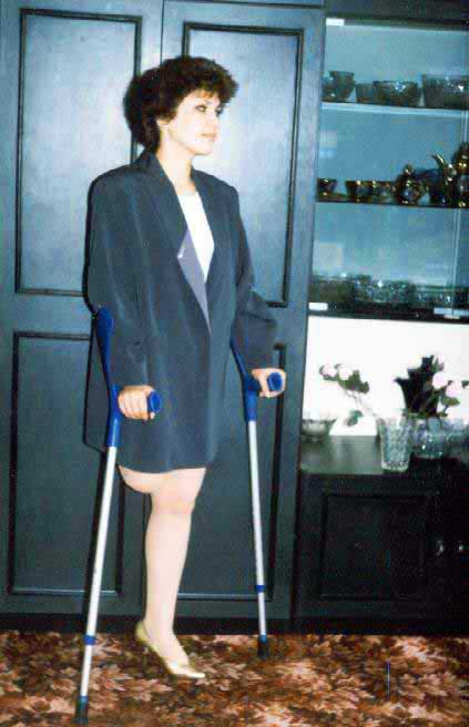 One Leg Amputee Woman Crutches Rose Petra