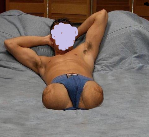 Male Amputee Porn