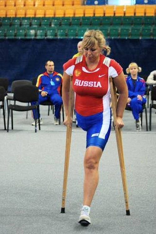 Ampdev. Ампути селебрити. Amputee RHD